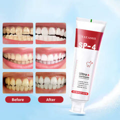 Yayashi SP4 Probiotic Whitening Toothpaste 120g
